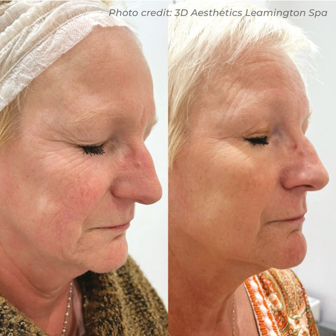 BA7_3D Leamington Spa_DMF_3 sessions