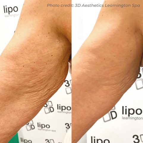 BA8_3D Leamington Spa_DMF_3 sessions